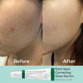 سرم ضد لک اکسیس وای مدل Dark Spot حجم 50 میلی لیتر