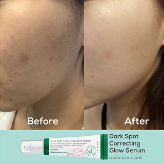 سرم ضد لک اکسیس وای مدل Dark Spot حجم 50 میلی لیتر